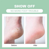 1472 SILICONE GEL HEEL PAD